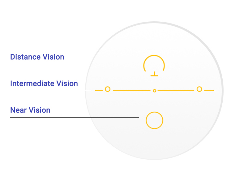 three major vision areas